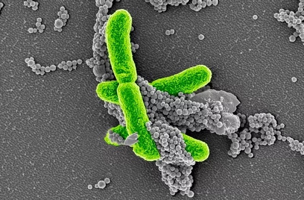 30年后科学家找到败血症研究新模子