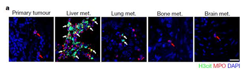 转入小鼠模子获得相同的试验效果，且在转移爆发前NET已在肝脏聚积。