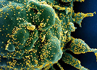 唾液检测新冠抗体新要领来了，获取效果仅需几小时！