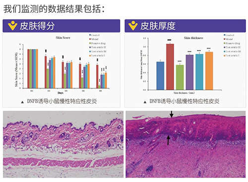 南宫28建设的特应性皮炎及湿疹模子监测数据效果