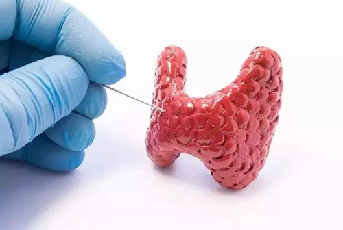 甲状腺疾。鬃聪俟πЪ跬撕图鬃聪俟πЭ航怨乓岳淳褪侵馗幢灰窖а芯恐霸毖芯康募膊