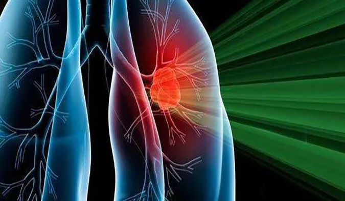 盛世泰科1类立异药物CGT-9475实现中美双报双批 | 南宫28一站式临床宿世物医药研发效劳平台助力