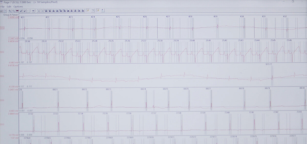 南宫28 SEND 数据转换平台