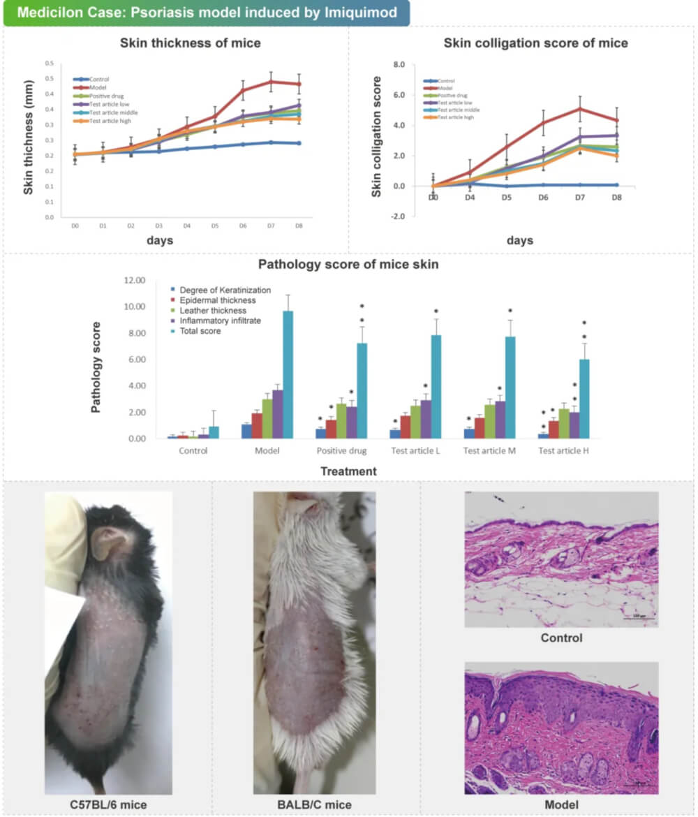 05 咪喹莫特诱导的银屑病模子.jpg